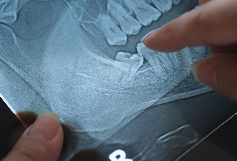 Zmack Chirurgie Mondheelkunde